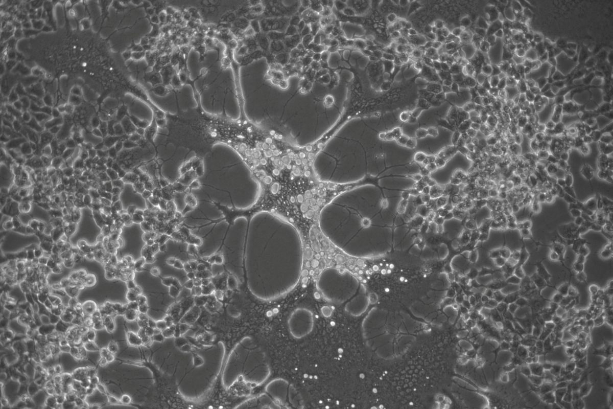 Descubren una nueva forma de atacar los herpesvirus